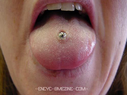 piercing lymph