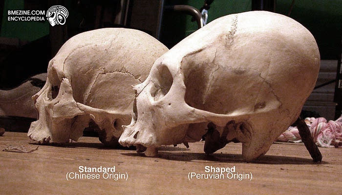 File:PeruvianSkull-1.jpg
