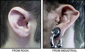 Ear Collapse-1.jpg