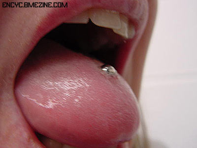 File:Tongue Swelling-1.jpg