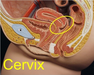 File:Cervix.jpg