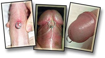 File:Shallow Genital Piercing-1.jpg