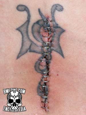 File:Tattoo Incision Damage-2.jpg