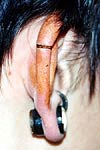 Ear Shaping-5.jpg