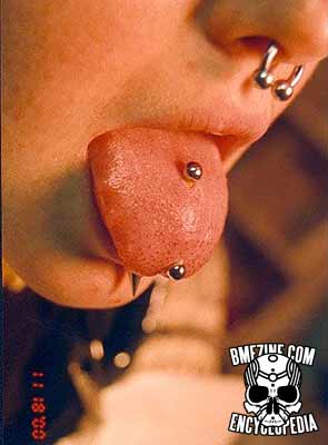 File:Tongue Surface Piercing-1.jpg