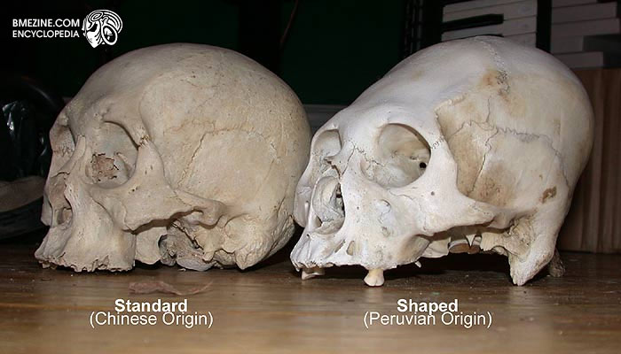 File:PeruvianSkull-2.jpg