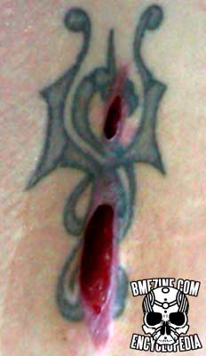 Tattoo Incision Damage-3.jpg