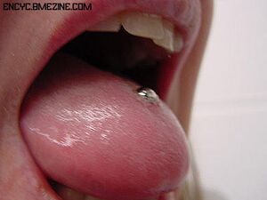 Tongue Swelling-1.jpg