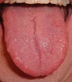 524px-Tongue.agr.jpg