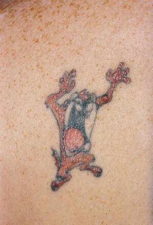 Hypersensitivity to permanent tattoos: Literature summary and comprehensive  review of patch tested tattoo patients 1997–2022 - Schubert - 2023 -  Contact Dermatitis - Wiley Online Library