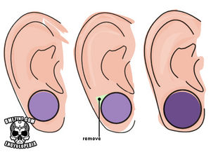 Earscalpdiagram.jpg