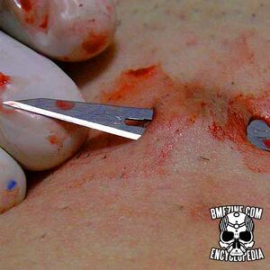 Fistula Transplant Piercing-3.jpg